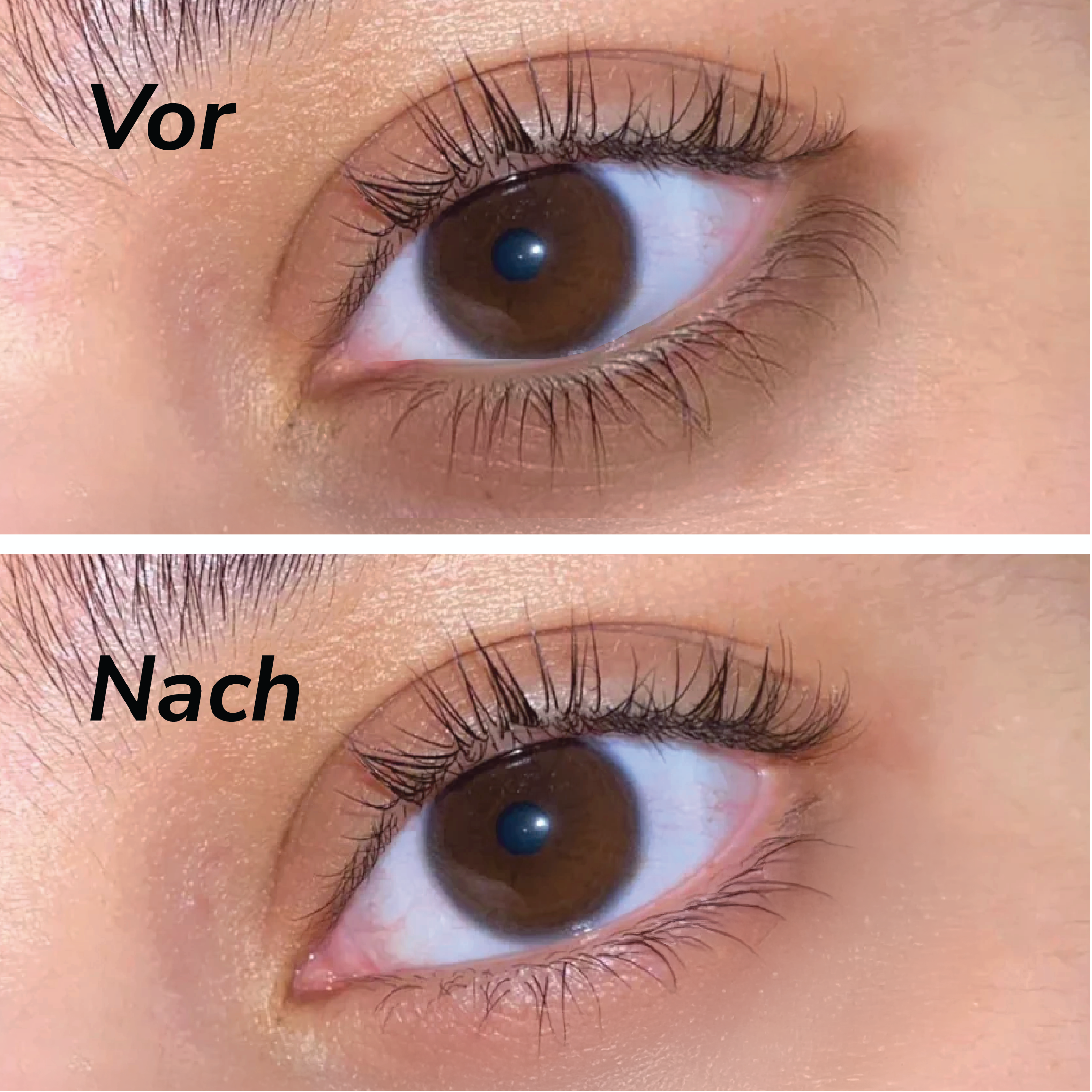 Teré Under Eye Massage Treatment Serum