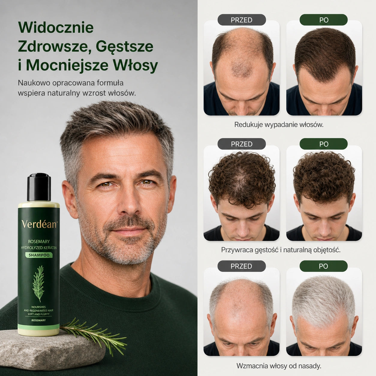 Verdéan™ Szampon Rozmarynowy | Naturalnie wzmacnia, zwiększa objętość i pielęgnuje włosy