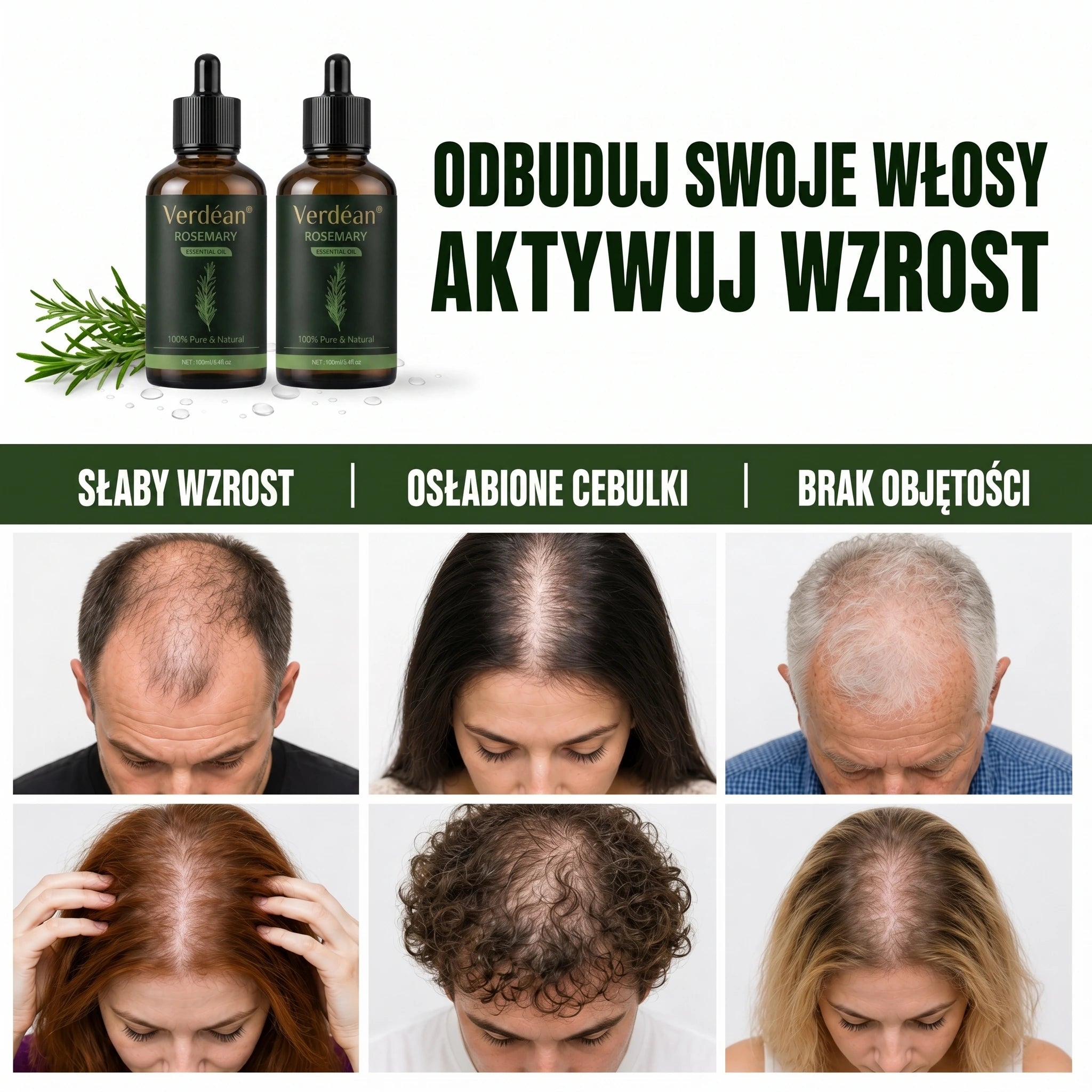 Verdéan™ Rozmarynowe Serum do Włosów | Stymuluje wzrost i widocznie zagęszcza włosy