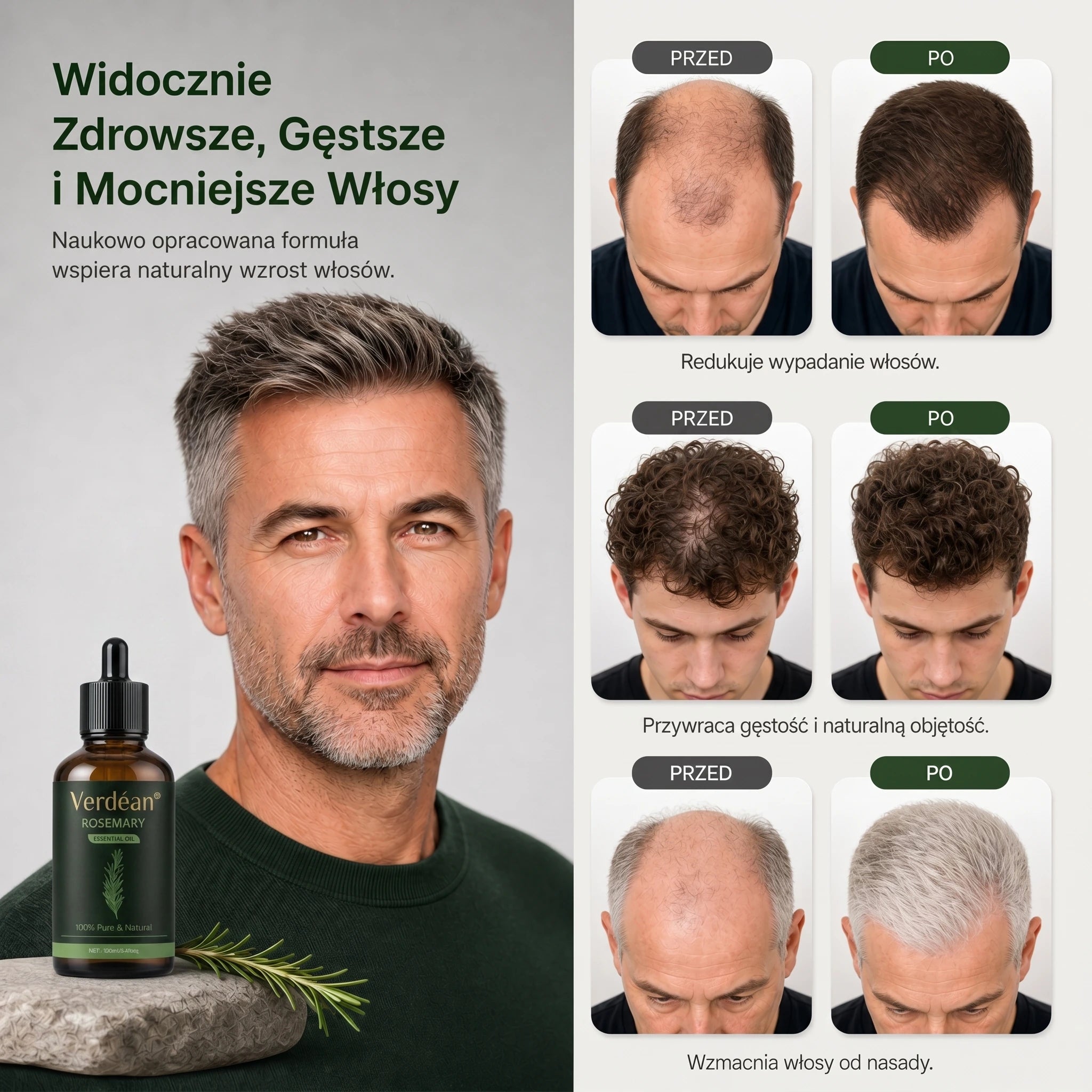 Verdéan™ Rozmarynowe Serum do Włosów | Stymuluje wzrost i widocznie zagęszcza włosy