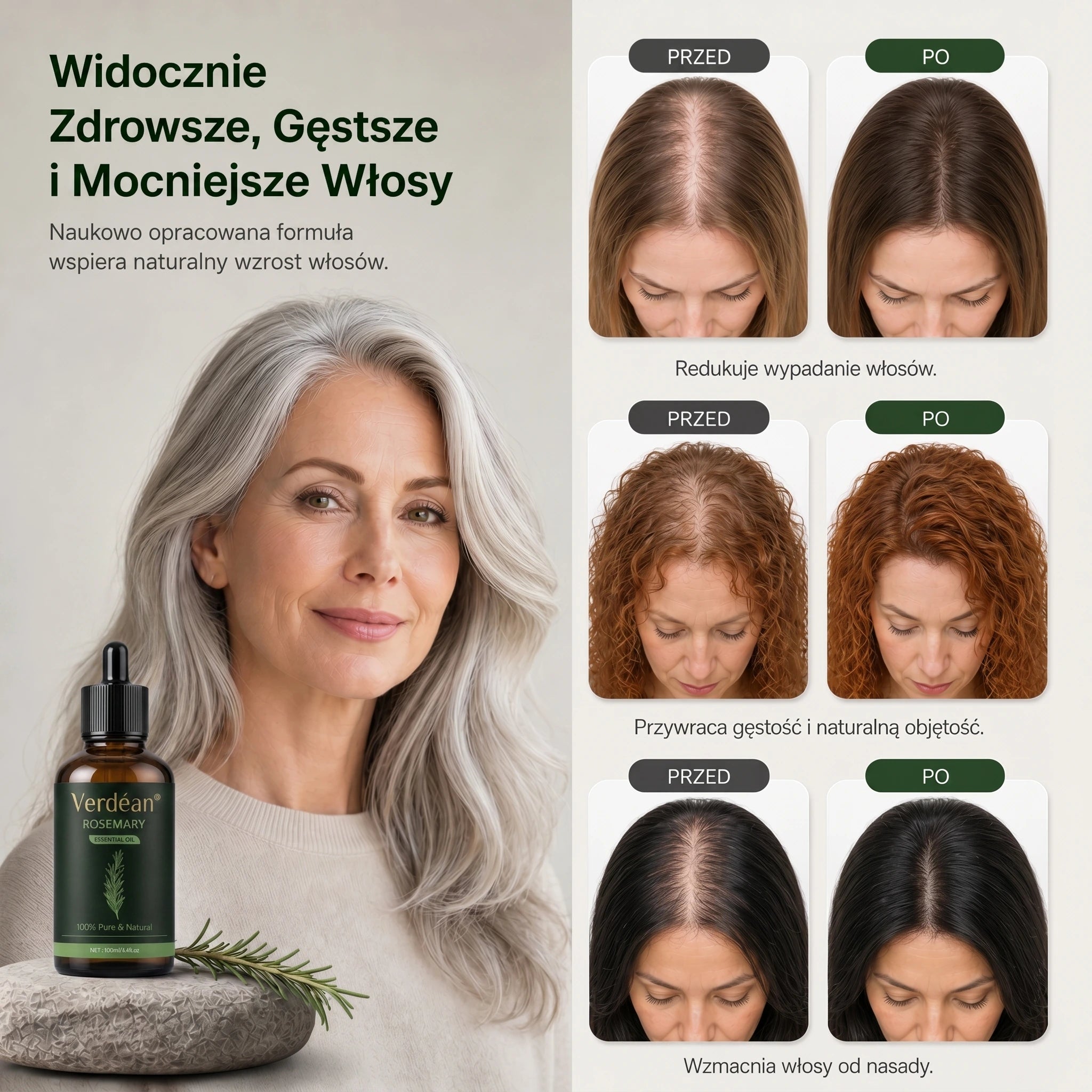 Verdéan™ Rozmarynowe Serum do Włosów | Stymuluje wzrost i widocznie zagęszcza włosy