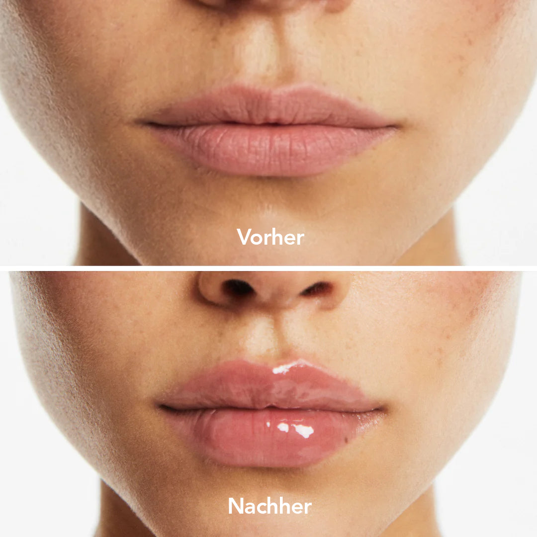 Teré Lip Treatment – Volumenizer Serum