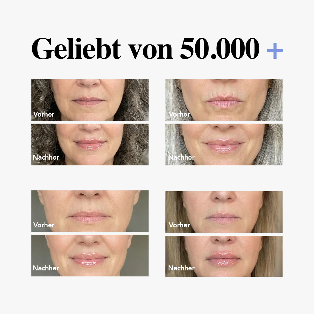 Teré Lip Treatment – Volumenizer Serum